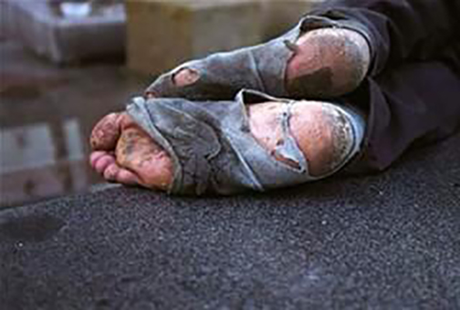 [Photo of rag-covered feet]